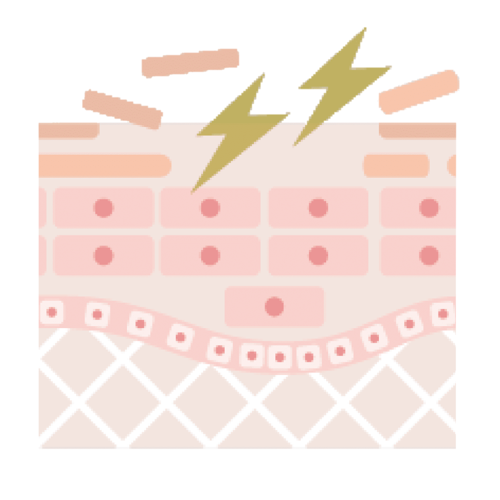 プラズマフェイシャルでターンオーバーを促進し、くすみ改善にアプローチするイメージ