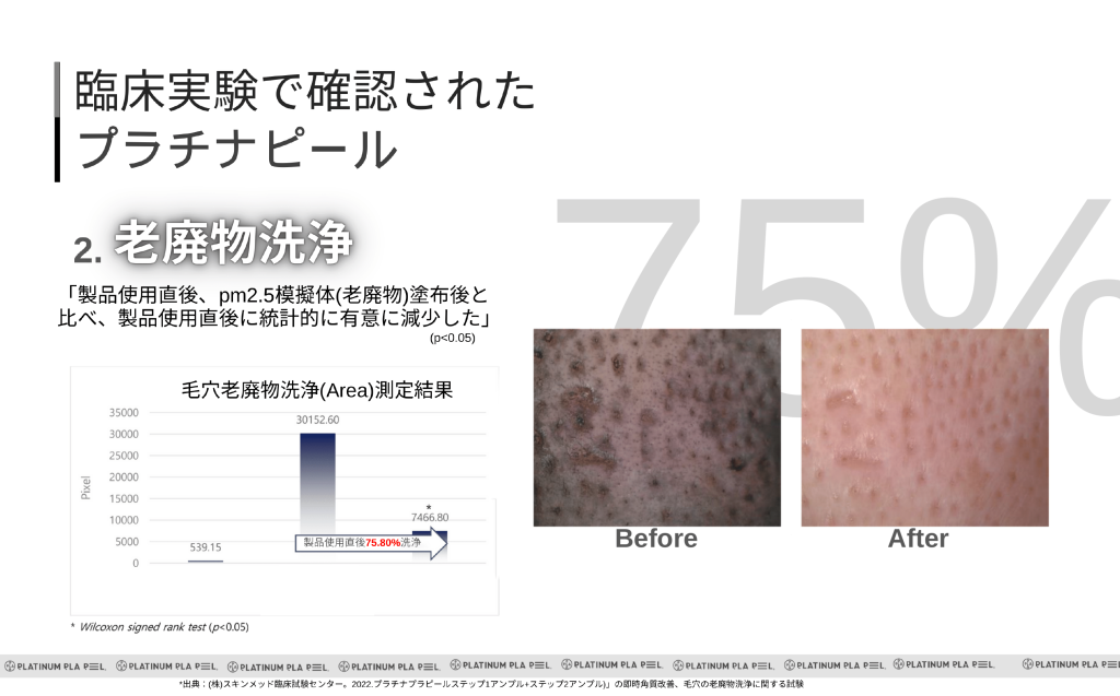 館山メンズピーリング プラピールの老廃物洗浄 ビフォーアフター臨床実験の説明とイメージ