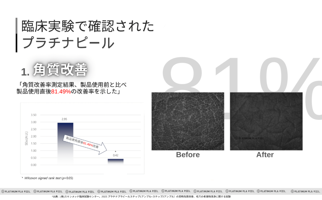 館山メンズピーリング プラピールの角質改善 ビフォーアフター臨床実験の説明とイメージ